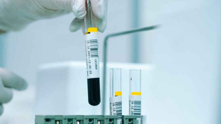 HbA1c (hémoglobine glyquée)