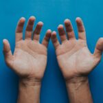 Grattage main droite